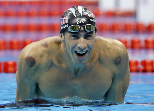  Superstar Michael Phelps uses cupping to aid recovery.